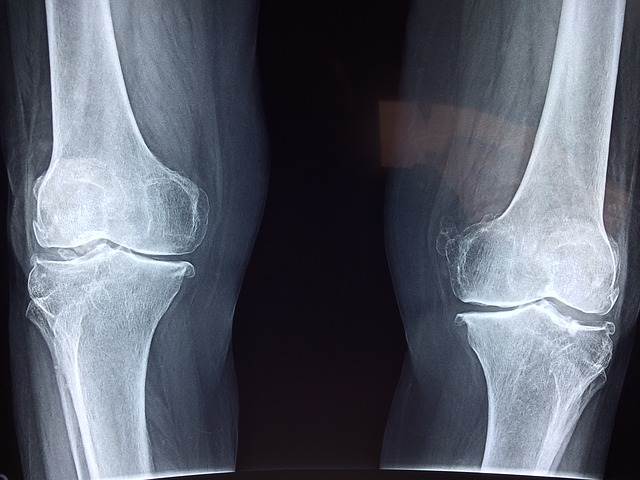 Magnesium is Essential for Bone Health