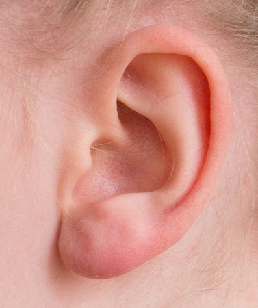 Chiropractic for Ear Infections